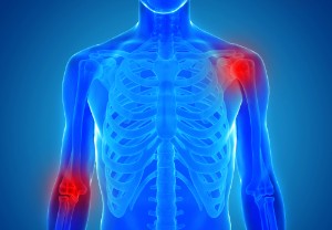 How to strengthen bones and joints – 15 tips for an elderly person after the age of 50, using vitamins, diet and lifestyle changes